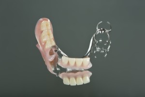 Crown and bridge of dental laboratory