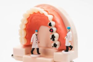 Customized dental design