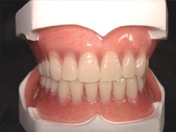 Acrylic Denture