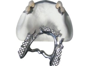 dental lab ball attachment