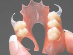 Flexible dental design