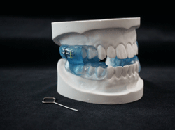 dental lab moses appliance