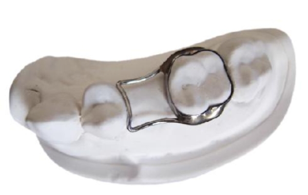 Space Maintainer for dental laboratories