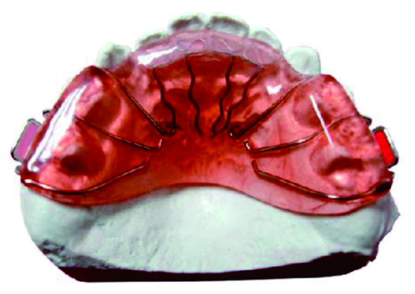 Spring retainer for dental laboratories