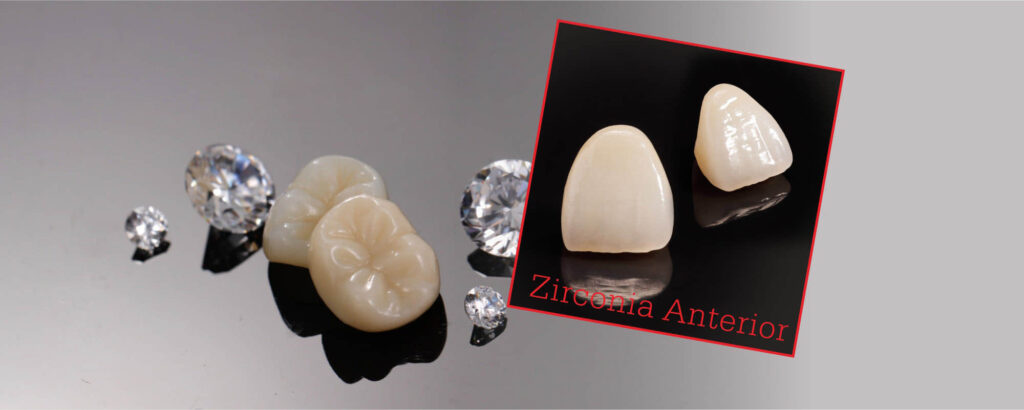 Conception d'externalisation de fausses dents implantées dans la dentisterie chinoise