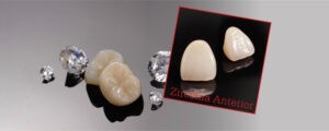 Design of implanted false teeth outsourcing in Chinese dentistry