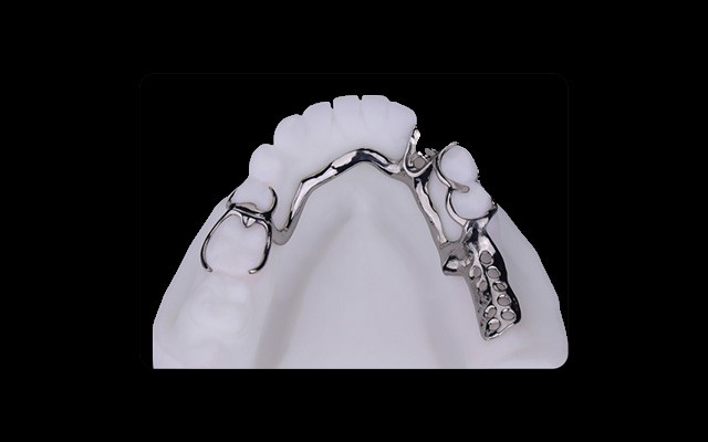 dental metal framework