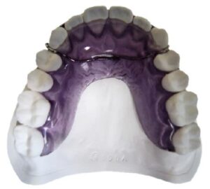 orthodontic
