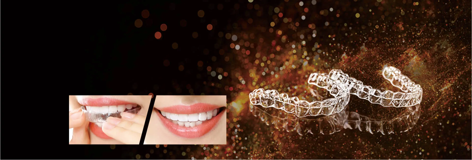 Dental Design-Clear Aligner